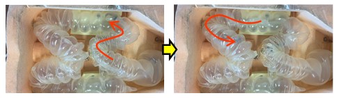 Helical Rotation Bundled Tube Device for Endoscopy